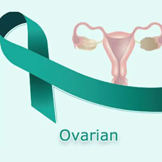 ovarian cancer panel test